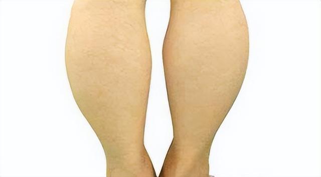 大腿肉多怎么瘦下来，大腿肉多怎么瘦下来运动（这些局部肥胖，怎么减下去）