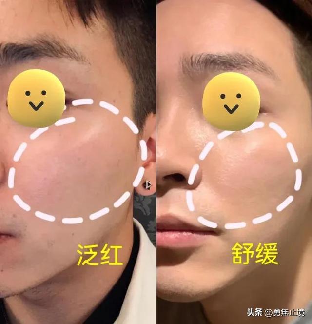 男士用什么面膜好,男生用什么面膜好(2022男士面膜专业测评) 男士用什么面膜好,男生用什么面膜好(2022男士面膜专业测评)