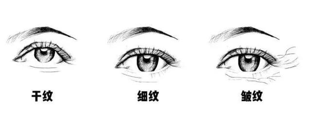 不要让眼部皱纹泄露了你的芳龄，注射伊维兰怎么取出（别让眼纹出卖你的年龄）