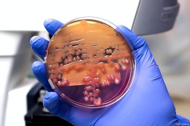 培养液是什么，MEM培养液是什么（<摘抄微生物培养基使用手册>）