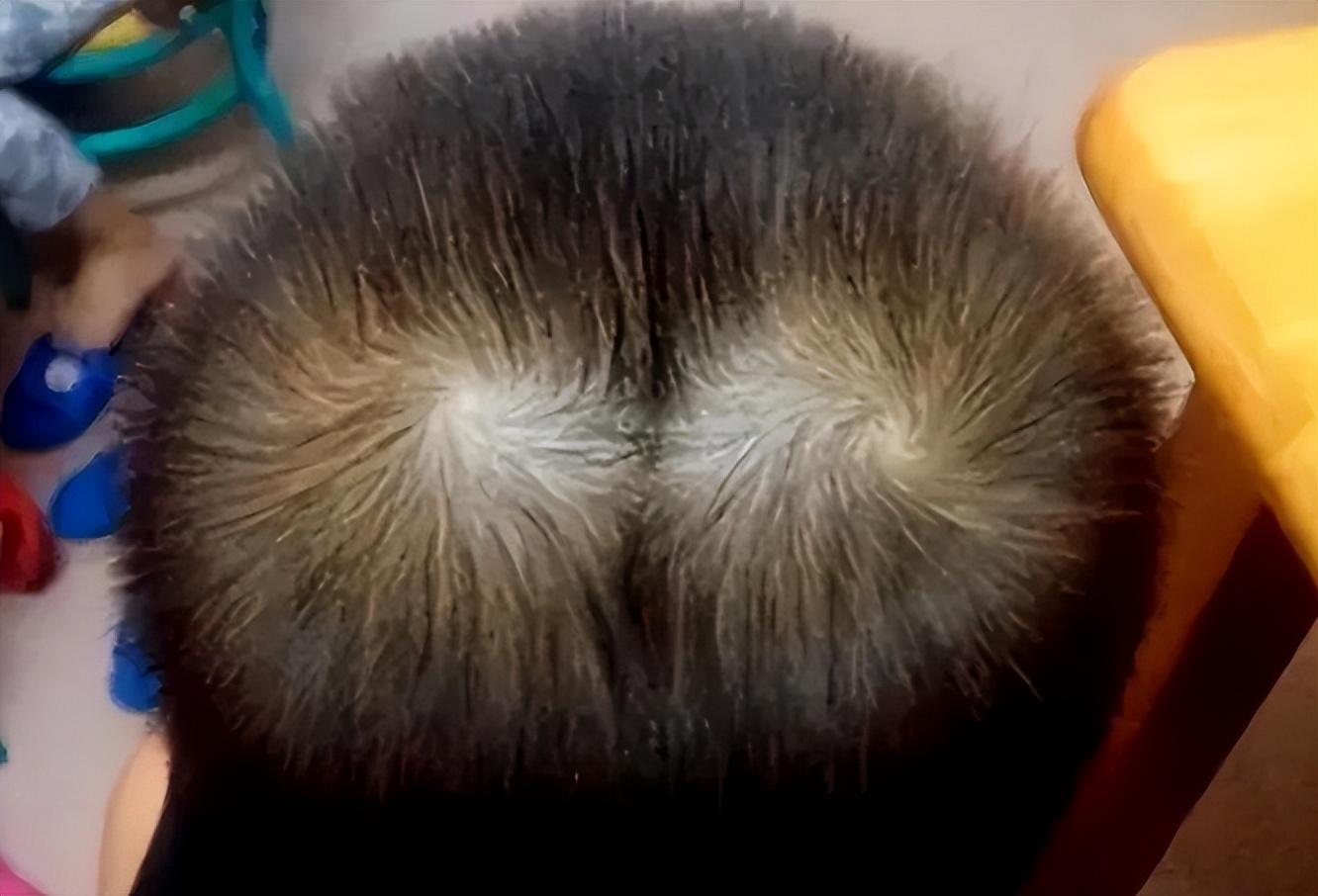 左耳小右耳大表示什么 面相,俗语"双顶男孩找不到-相术-荣耀易学