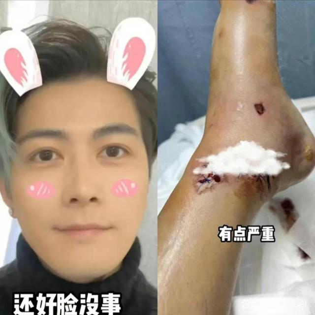 郭敬明陈学冬恋情，郭敬明为什么喜欢陈学冬（33岁陈学冬遭遇严重车祸）