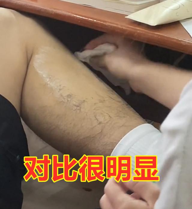 女生如何去腿毛，女生腿毛怎么永久去除（2条毛腿瞬间光滑白嫩）