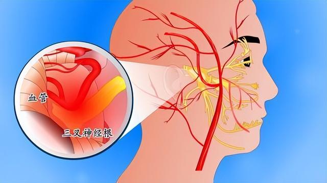 哭会对身体造成多大的伤害，经常哭的危害（疼痛排名前4的疾病）