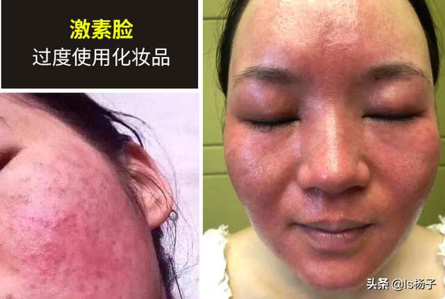 没有卸妆水可以用什么代替，没有卸妆水用什么代替（有没有什么一瓶就可以代替多瓶的只擦一种就可以的护肤品）