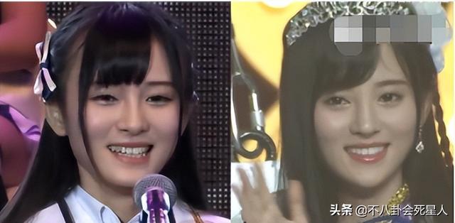 整容后遗症有哪些，整容后遗症有哪一些（明星整容后遗症明显）