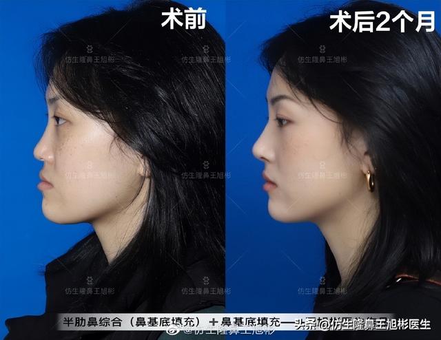 高级脸是什么意思，6种脸型不显老（“月亮脸”逆袭“高级脸”的不二法则是）