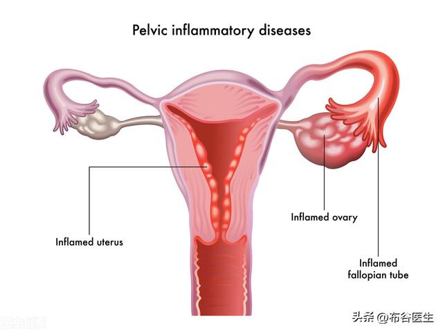 右腹部隐隐作痛怎么回事女性，女性右下腹部隐痛的原因有哪些（女性盆腔炎有什么症状）