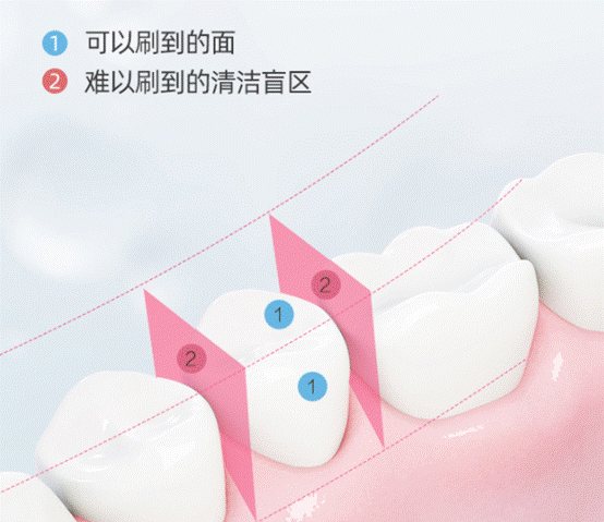 水牙线真的有害吗，冲牙器骗局是真的吗