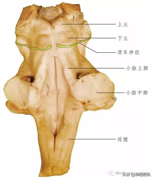属于膜迷路的结构是，属于膜迷路的结构是蜗管蜗顶（彩图经典版│脑神经和脑神经核解剖）