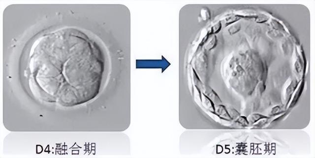 囊胚分几个等级，养囊胚有几个等级（囊胚4bb、4ab、4cb是什么级别）