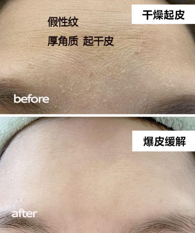 脸部能天天热敷吗，热敷脸有哪些功效与作用（面膜可以天天敷吗）