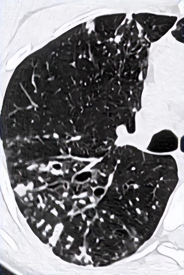 发霉的房间住一天对人的影响,家里潮湿发霉对人体的影响(墙上有霉斑