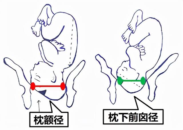 生孩子是突然发动还是有预兆，分娩发动是突然的吗（胎位为什么头先出来是正常）