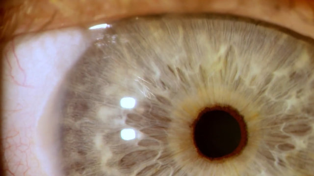 人眼是什么结构，人眼的主要结构（究竟如何进化而来的）