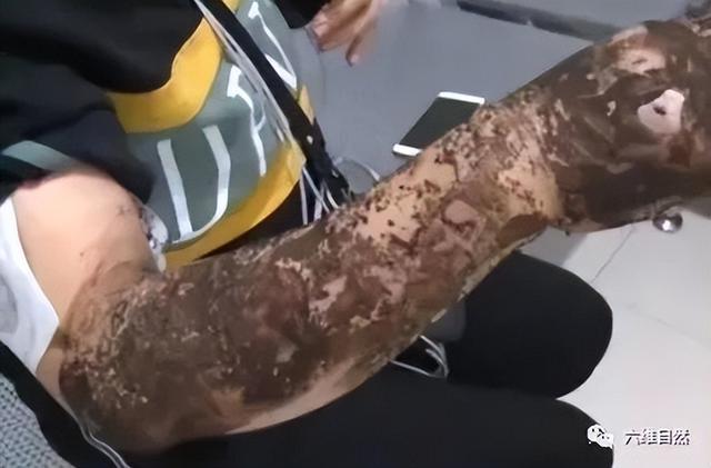 猫为什么可以跟毒蛇打架，猫和蛇打架猫不怕毒吗（重庆一只小猫叼着小毒蛇回家）