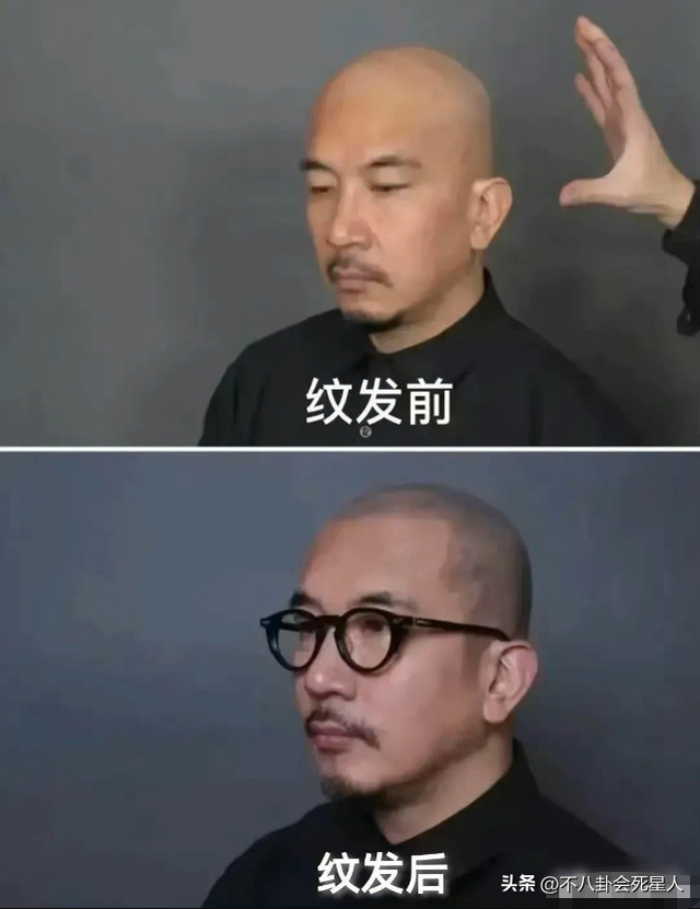 杨幂的发际线是什么样的，14位明星增发妙招