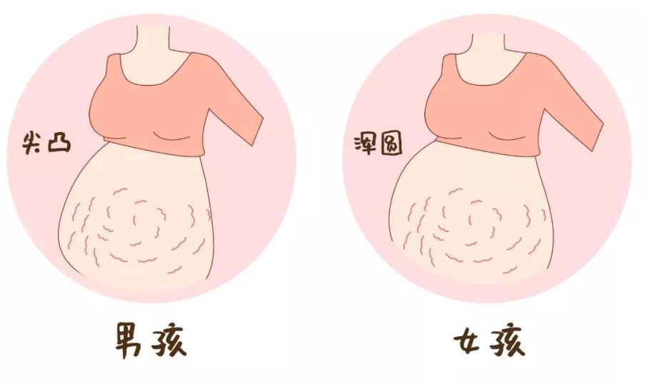 民间有说法称,"肚子尖尖生男孩,肚子圆圆生女孩".