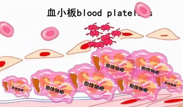 血小板高如何治疗，老年人血小板减少症治疗的最好方法（血小板减少的正确治疗方案是什么）