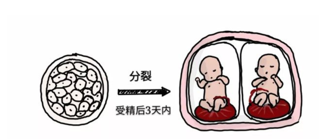 生孩子是从哪个部位生出来的，宫外孕的概率有多大（注定被“割”下的寄生胎）