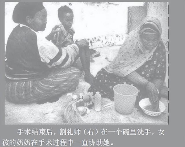 什么叫割礼，什么叫割礼手术（1.3亿人遭受的割礼之痛）