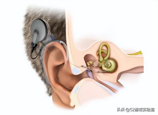 耳蜗的作用是什么，耳蜗的主要功能是什么（进口人工耳蜗30万）