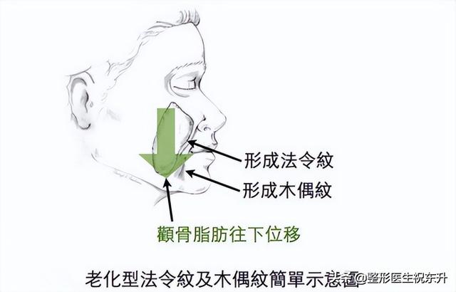 怎样淡化法令纹，怎么淡化法令纹（这“3个方法”实用又有效）