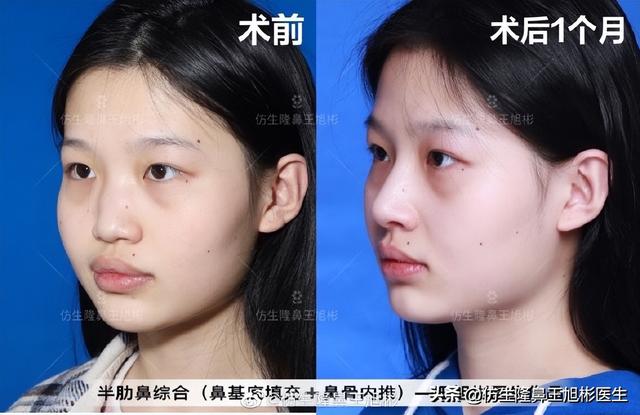 高级脸是什么意思，6种脸型不显老（“月亮脸”逆袭“高级脸”的不二法则是）