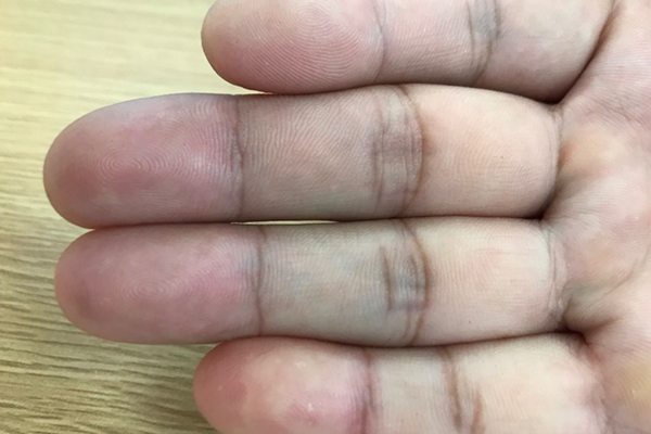 几个斗代表什么命运，手指上几个斗代表不同的命运（一斗穷，二斗富，未来早已注定）