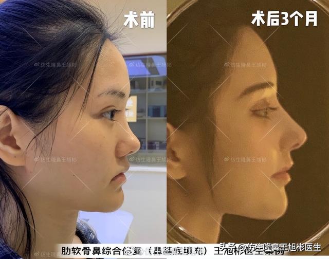 高级脸是什么意思，6种脸型不显老（“月亮脸”逆袭“高级脸”的不二法则是）