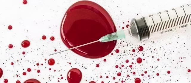 艾滋病怎么得的，男性怎么判断自己有没有性疾病（洁身自好，为什么还会得艾滋病）