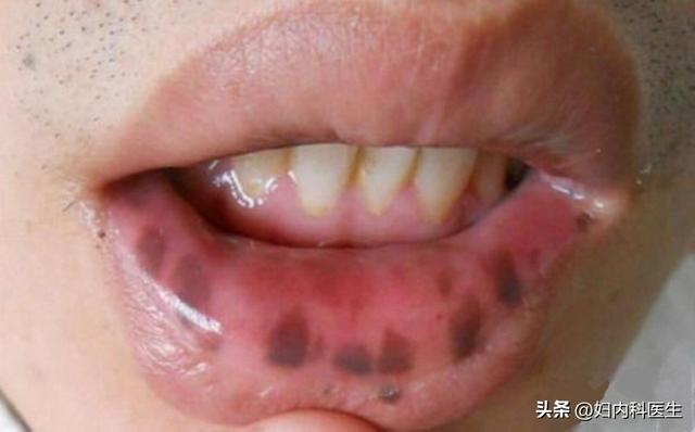 脸黑是什么病，脸黑是什么病症（如何通过脸色表情判断身体的毛病）