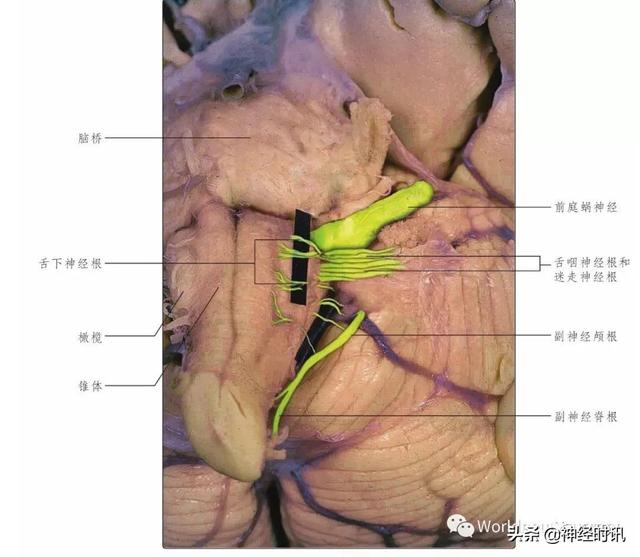 属于膜迷路的结构是，属于膜迷路的结构是蜗管蜗顶（彩图经典版│脑神经和脑神经核解剖）