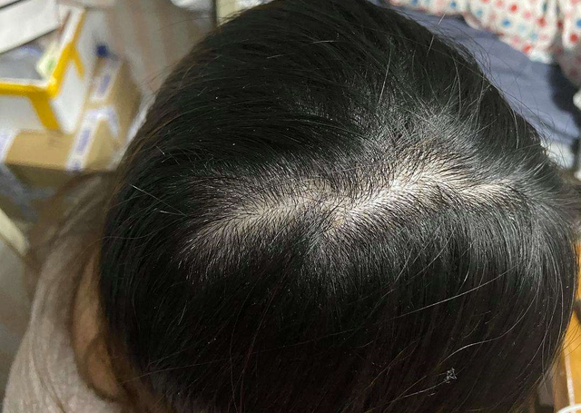 什么时候洗头发最好，洗头发哪个时间最好（多久洗一次头发比较好）