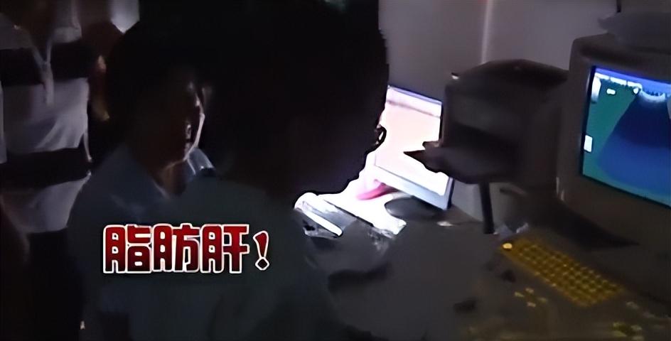 怀孕4个月胎儿图片，四个月真实胎儿（医生检查后哭笑不得）