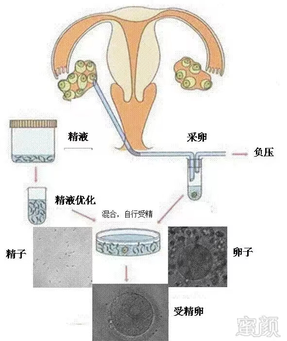 受孕过程是怎么样的，受孕的过程是什么感觉（原来，受精生理过程是这样的）