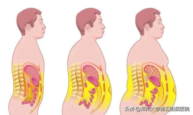 什么是内脏脂肪 如何摆脱内脏脂肪，什么是内脏脂肪（实际上内脏脂肪可能已超标......）