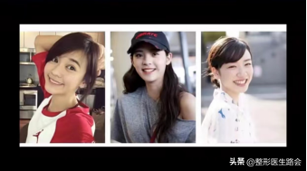 鼻翼肥大怎么办，鼻翼肥大怎么改善（如何改善鼻头圆和鼻翼宽）