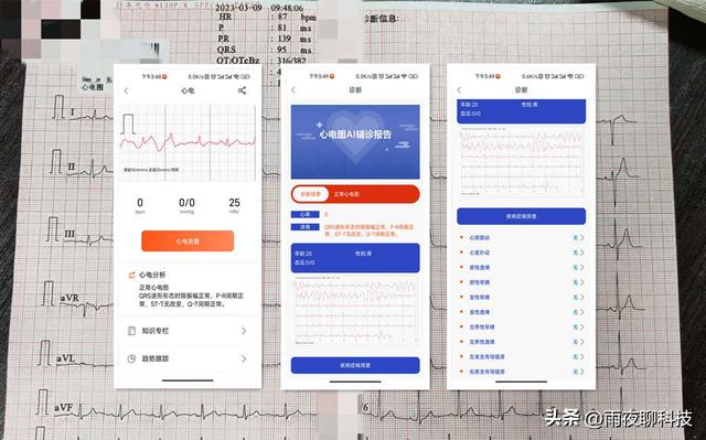 微信运动计步神器苹果手机，心电血糖轻松测，dido