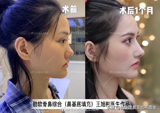 高级脸是什么意思，6种脸型不显老（“月亮脸”逆袭“高级脸”的不二法则是）