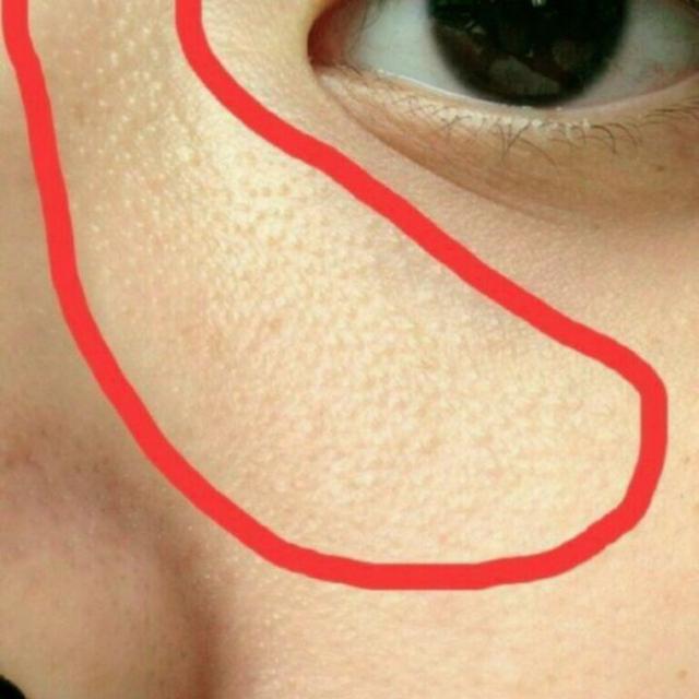 脸部能天天热敷吗，热敷脸有哪些功效与作用（面膜可以天天敷吗）