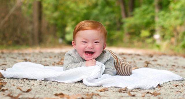 6号微小染色体缺失，英国女孩变成“三无人类”