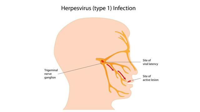 嘴巴上火起泡怎么办，嘴巴起泡怎么办（你以为的“上火”）