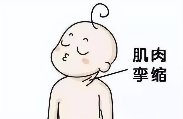 歪脖子是什么意思，涟漪是什么意思怎么读（关于小儿斜颈，你知多少）