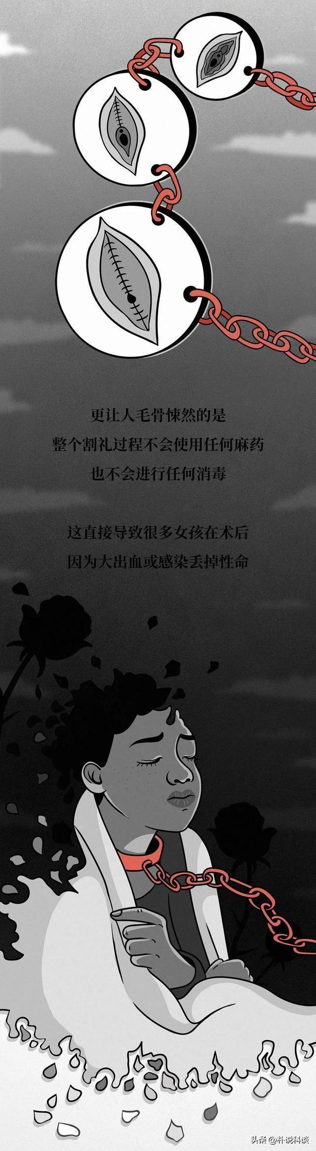 非洲割礼指的是什么，非洲割礼的到底是什么（你知道是什么意思吗）