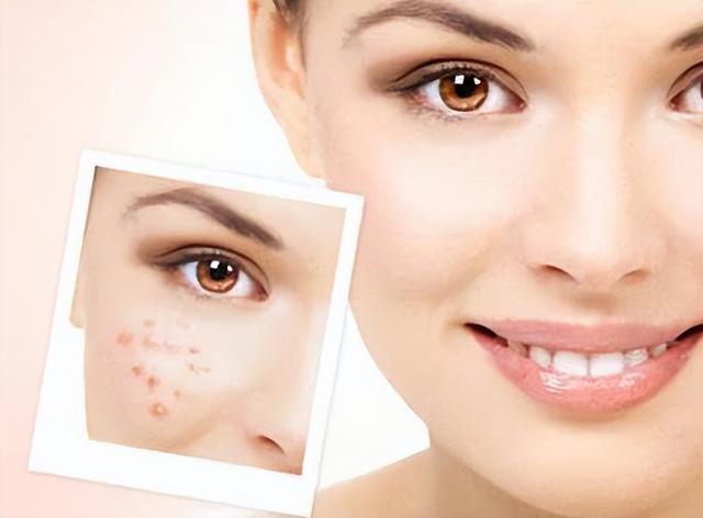 面部毛孔粗大的原因有哪些，面部毛孔变得粗大的原因（瓷蕊：毛孔粗大什么原因造成的）