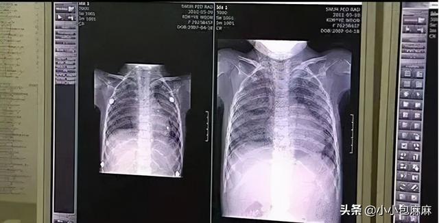 加湿器的作用及好处，加湿器的作用（加湿器，为什么不能乱用）