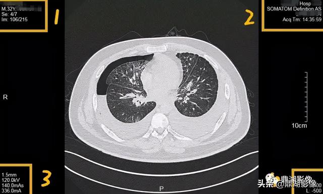 r和l哪个是左哪个是右，袜子r和l哪个是左哪个是右（竟然包含了这么多的信息）