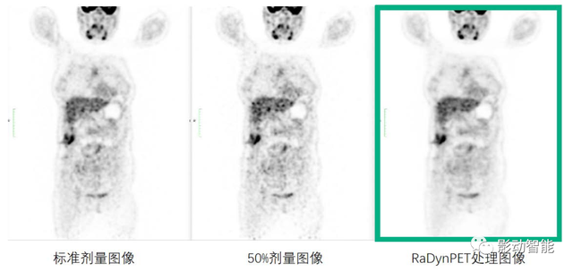 孕期检查时间，孕妇做检查时间表（备孕与妊娠期间进行影像检查应注意哪些事项）