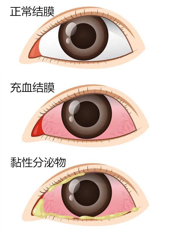 瞥是什么意思，《说文解字》第661课